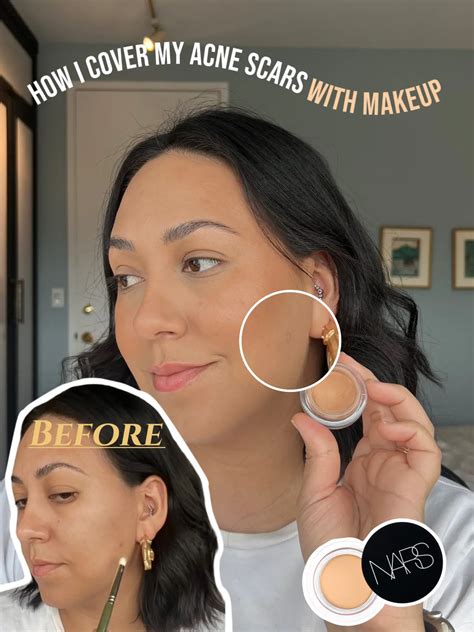 How To Hide Pockmarks With Makeup | Saubhaya Makeup