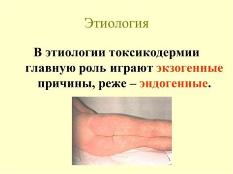 Презентация - Токсикодермия » Привет Студент!