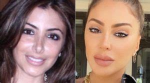 PHOTO Larsa Pippen Before And After Plastic Surgery