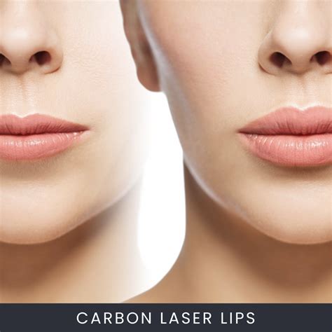 carbon laser lip plumping    beauty courses