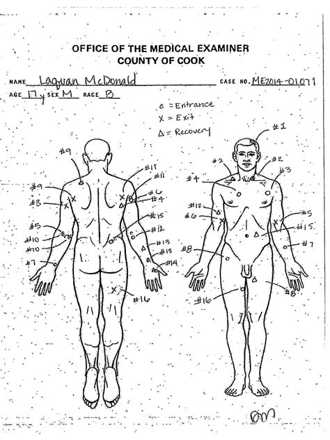 An autopsy diagram provided by the Cook County Medical Examiner's