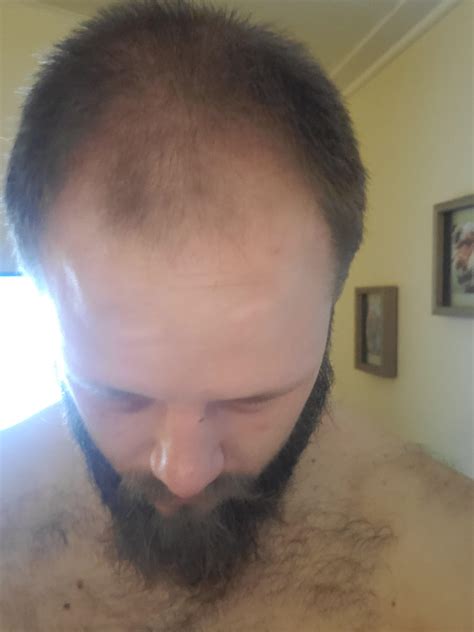 I'm 26 and really struggling with my self confidence. I am almost