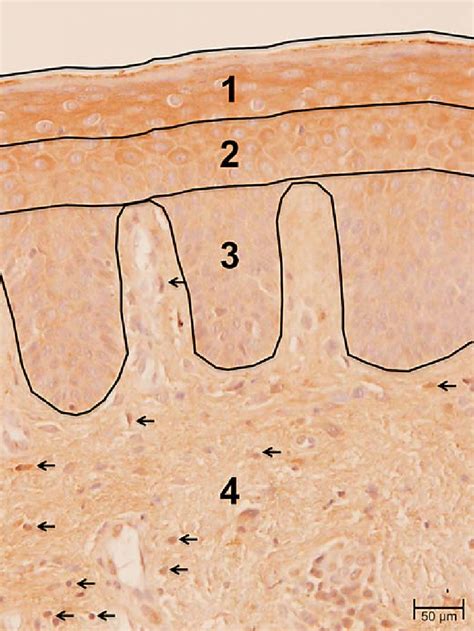Photomicrograph (magnification ×400) illustrating the different ROI. 1 ... 