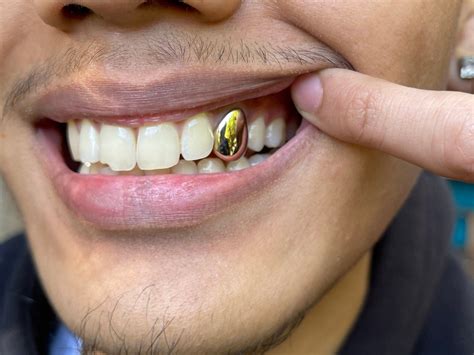 Tarnish Free Dental Gold Tooth Cap Grillz, Smoke Proof UK Worldwide ...