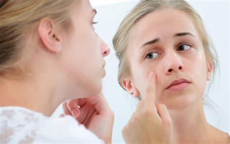 Mom, Why Is My Face Breaking Out? – askderm