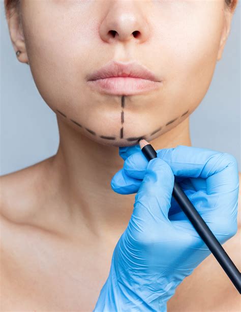 Chin Cosmetic Surgery – Are Health Clinic