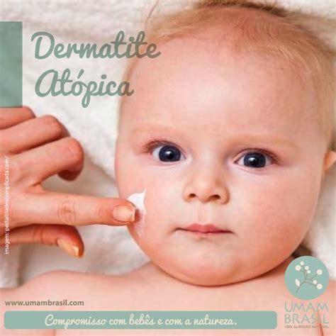 Dermatite Na Orelha Do Bebe