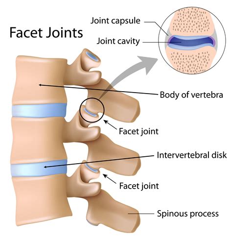 Facet Joint Pain - Back Care Clinic