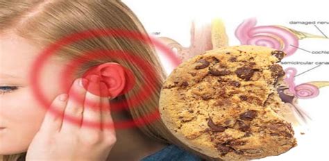 cookie bite hearing loss  signs  treatment ceretone