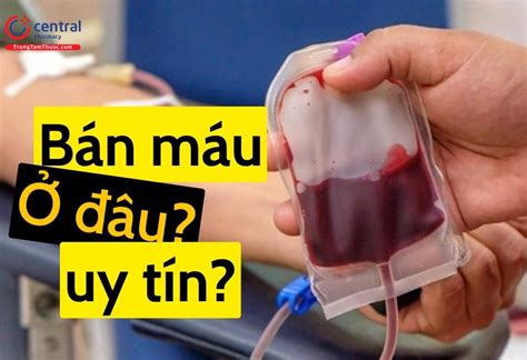 nen ban   dau ha noi hcm gia ban  la bao nhieu