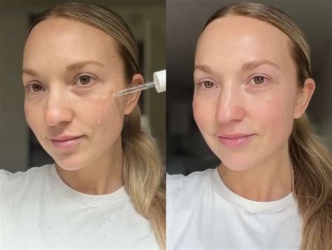 pyruvic acid  skin benefits  safety guide
