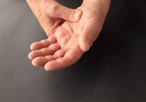 How Does Carpal Tunnel Syndrome Happen? - Falcon Plastic Surgery