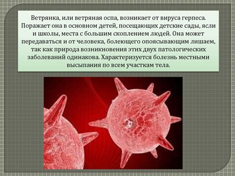 Заболевания с воздушно-капельным путем передачи: ветряная оспа ...