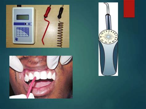 PULP VITALITY TEST.pptx