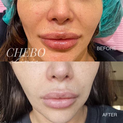 InfluencerGoneWild's Before & After: The Results Will SHOCK You! Image 5
