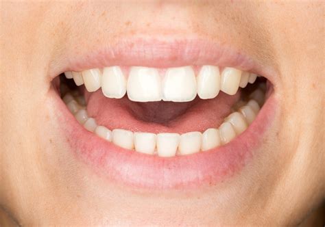 Warum heilen Wunden im Mund so schnell? - wissenschaft.de