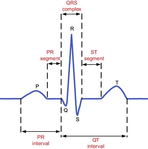2 ECG standard waveform. | Download Scientific Diagram
