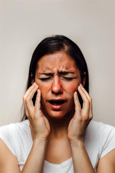 Plötzlicher Ausschlag Im Gesicht - Captions Beautiful