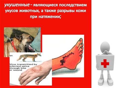 Первая помощь при травмах различных областей тела - презентация онлайн