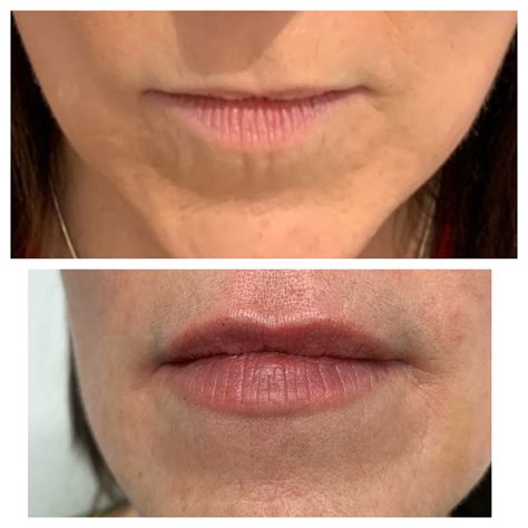 Photo Gallery | Austin Regenerative Therapy