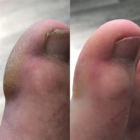 Stride Foot Clinic - Home | Facebook