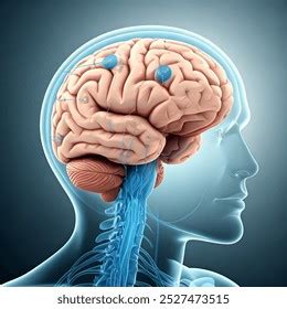 deep brain stimulation royalty  images stock  pictures