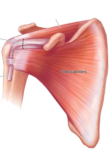 how to fix rotator cuff tendonitis