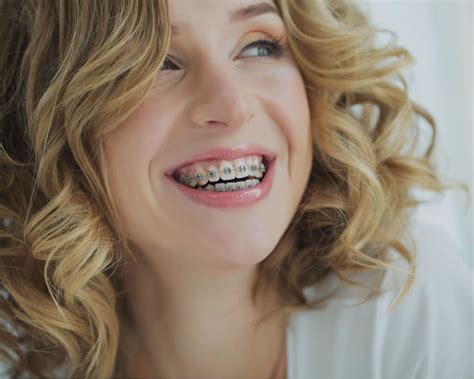 baldwin park dental center braces  adults