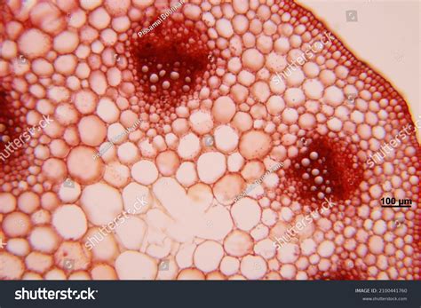 193 Collenchyma Sclerenchyma Parenchyma Cells Images, Stock Photos ...