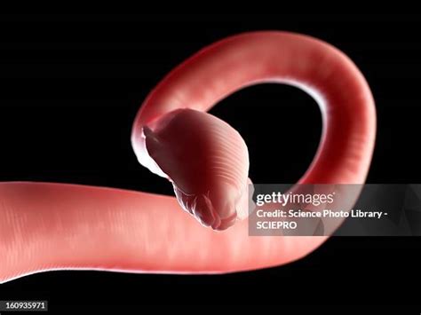 753 Images Of Roundworms Stock Photos, High-Res Pictures, and Images ...