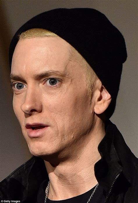 eminem face | Surgery VIP