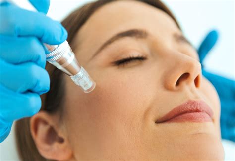Para Qué Sirve La Mesoterapia Facial | hedonai