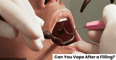 how long should i wait to vape after a filling