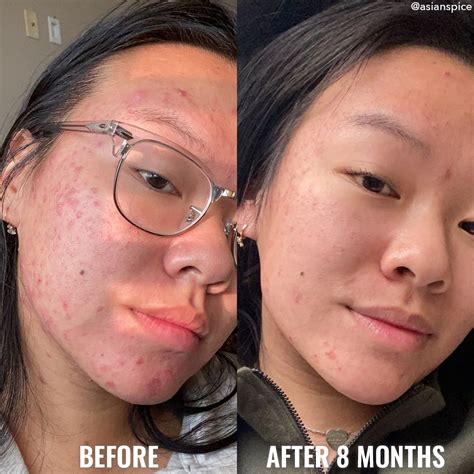 Discoloration Correcting Serum