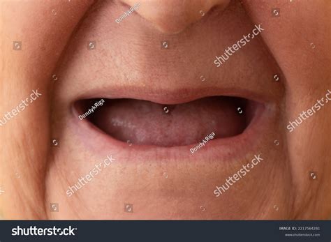 mouth  teeth options  replacing missing  irreparably