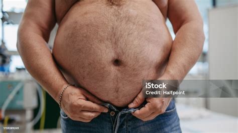 과체중 환자의 복부 클로즈업 뚱뚱한 남자의 허리 둘레가 높고 뱃살이 뚱뚱하다 과폭과 비만의 건강 위험 개념 심장 질환에 대한 ...