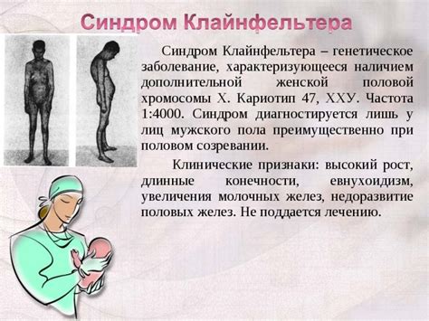 Синдром Клайнфельтера | Справка.Неинвалид.ru