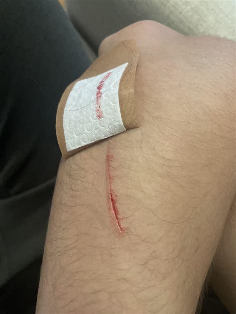 Is Your Cut A Coup De Grâce Or A Minor Faux Pas?