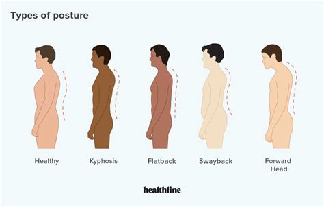 types  posture   correct bad posture artofit