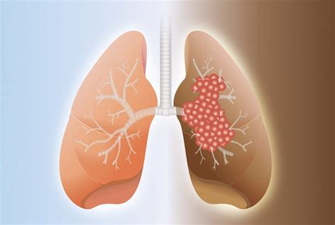 Health Symptoms : Causes, Treatment, Conditions and More