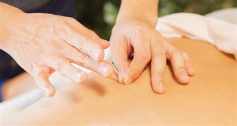 How Does Acupuncture Work - Artupuncture Clinic