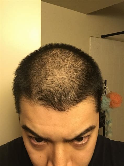 Should I shave it? : r/bald