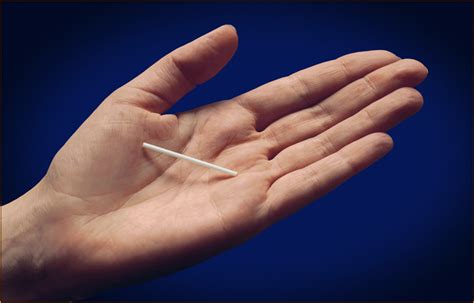 arm bar implant birth control  albert avila blog