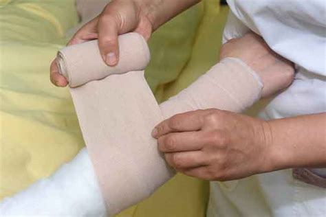 Compression Sleeves For Lymphedema – The People’s Gallery