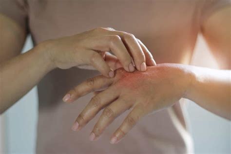 What is an Adverse Drug Reaction and How to Treat It? - Burt's Rx