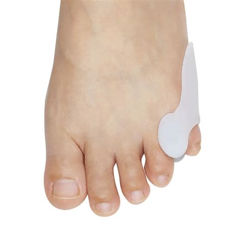 how to fix bunion