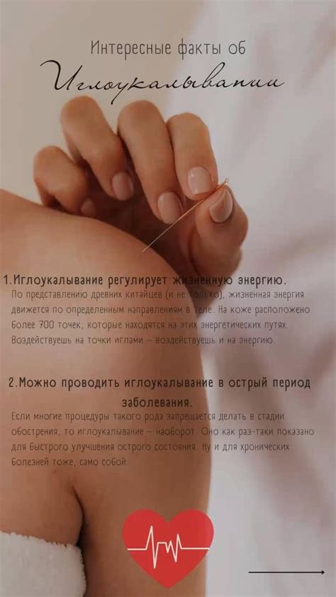 Интересные факты об иглоукалывание | Иглоукалывание | Рефлексотерапия
