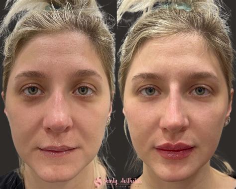 Jw Woodward: Before & After Results That Will Shock You Image 20