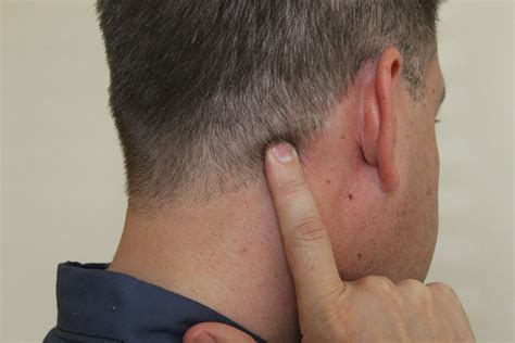 How to do a self test for headache pain
