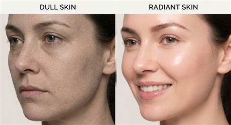 dull skin  radiant skin mayerling skin renewal system  division